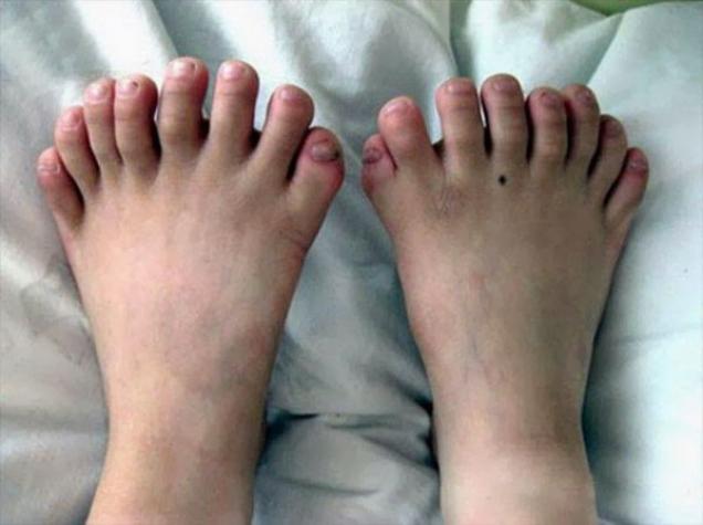 25 Most Bizarre Hands and Feet Ever!