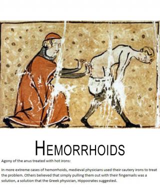 Most Horrible Medieval Surgeries And Medical Procedures