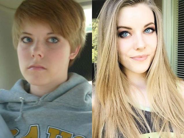 25 People That Went Through Amazing Transformations After Puberty