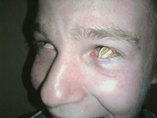 Kilgore's Nocturnal Exposition