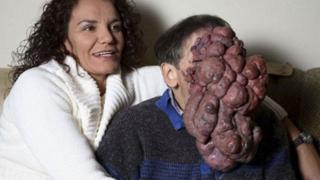 15 Tragic Facial Deformities