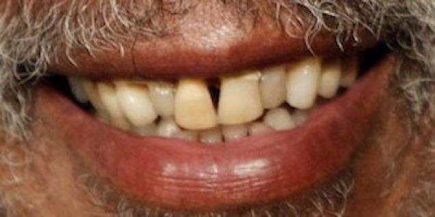 Which famous celeb do these horrible teeth belong to?