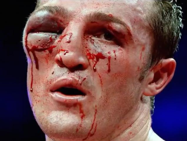 The Most Horrific Post-Fight Faces Ever