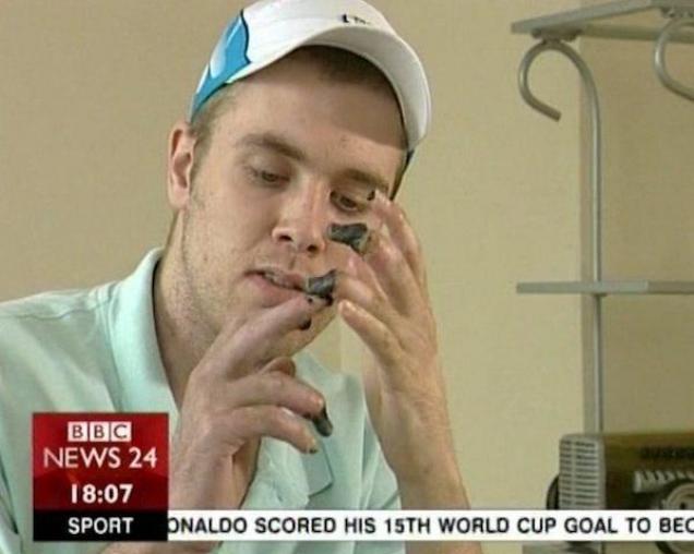 9 Horrifically Botched Clinical Trials