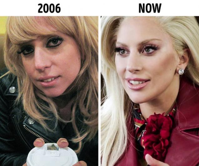 15 Celebrities at the beginning of their careers and now.