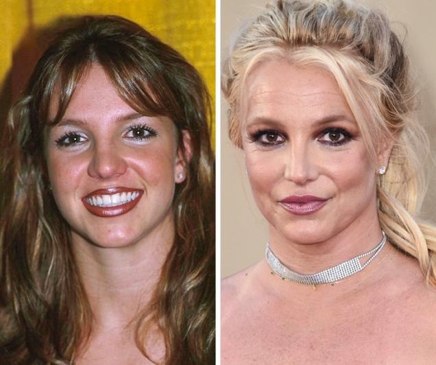 17 Now and Then Pictures of Celebrities.