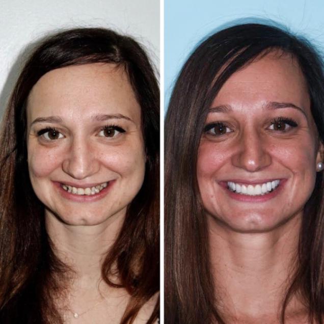 24 People Who Made Amazing Transformations in Their Lives.