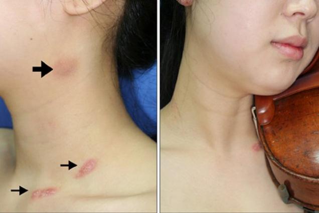 18 Body Deformities People Got From Their Jobs.