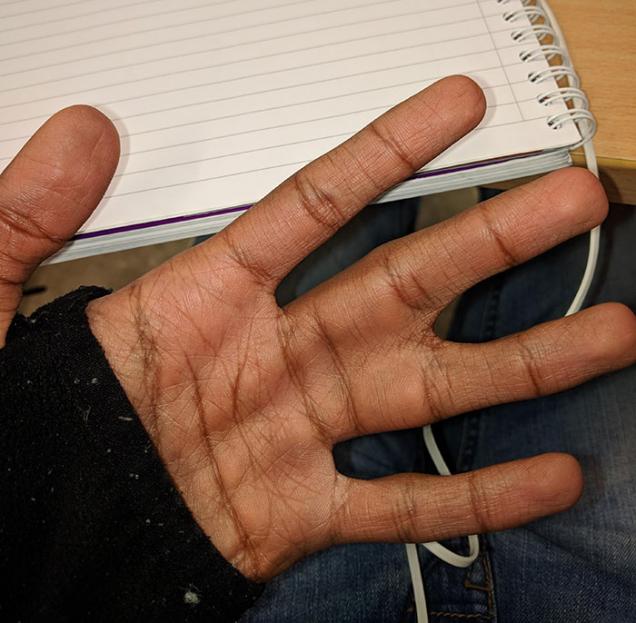 26 People With Unique Things About Their Bodies.