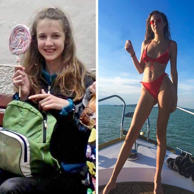 21 Ugly Ducklings Who Grew Up.