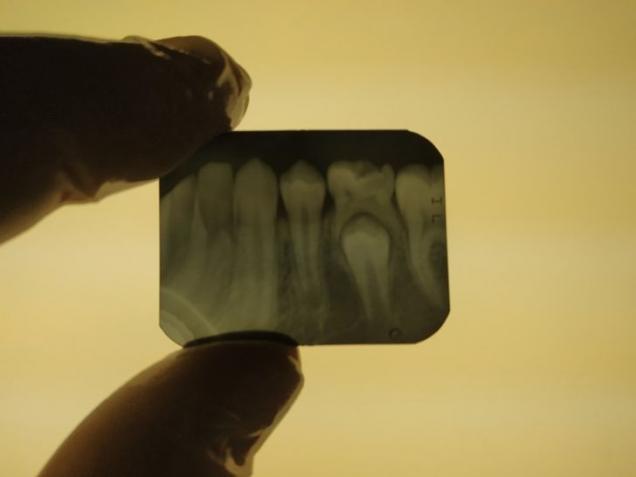 14 X-Rays of Interesting Things.