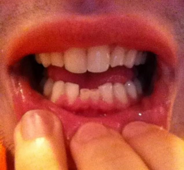 20 People Who Have Genetic Anomalies.