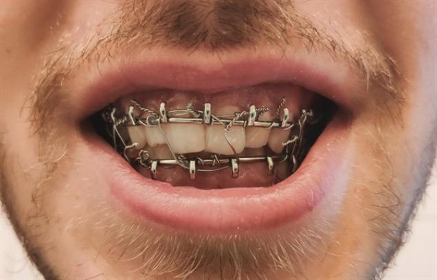 25 Times Sh*t Happened.