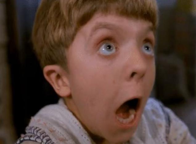 18 Stupid Ways People Got Scars.