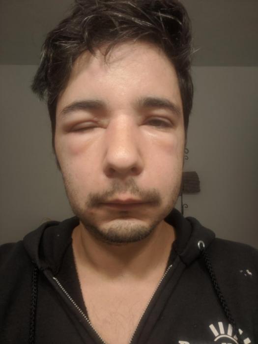 23 People Whose Day Couldn't Get Any Worse.