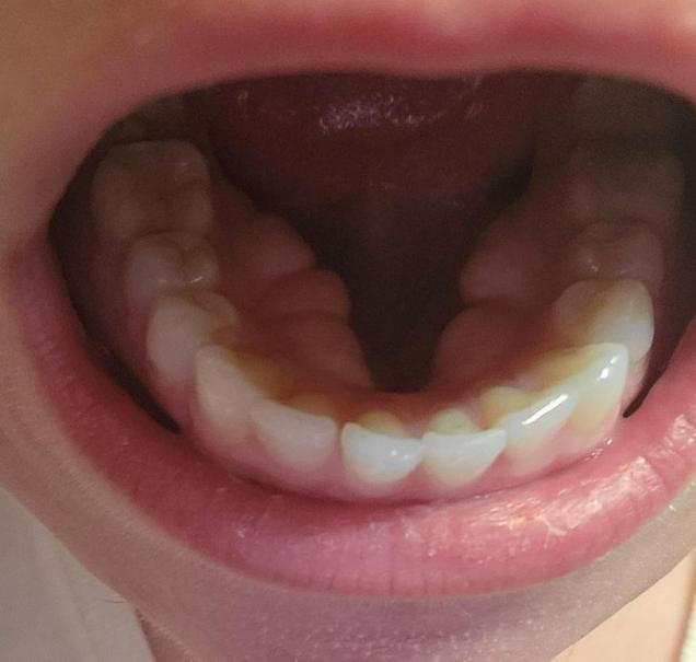 18 Things Seen From Hidden Sides.