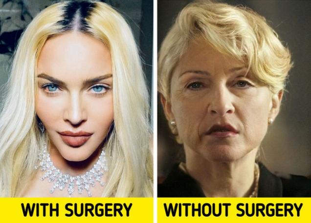 What 9 Celebrities Would Look Without Surgery.