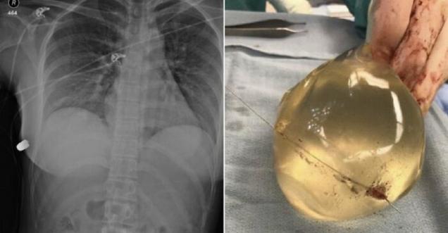 35 Scary Facts That Just Might Ruin Your Day.