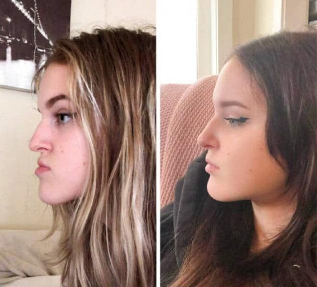 41 Cool Before and After Photos