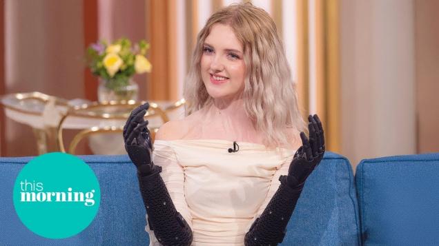 Meet The Teen With The World’s Most Advanced Bionic Hands