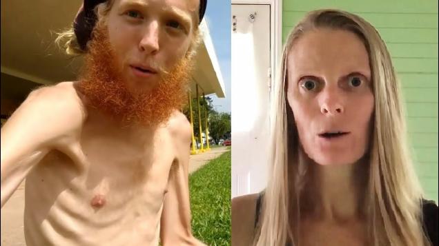 Vegans: The Epitome of Malnourishment