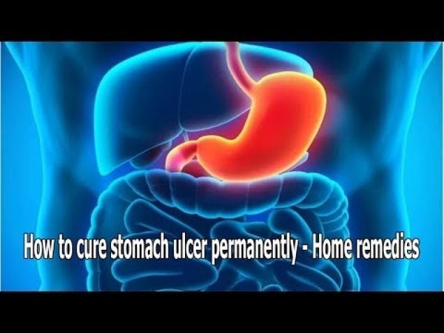 Information Health|How To Cure Stomach Ulcer Permanently - Home ...