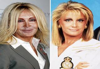 19 Plastic Surgery Nightmares Will Haunt Your Dreams - Gallery | eBaum ...