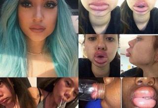 Kylie Jenner's lips have changed A LOT in the past year or so:Kylie claims that it's the result of makeup and not plastic surgery and/or injections. Um, okay. It's not like her family is well known for being FAKE AS HELL or anything.