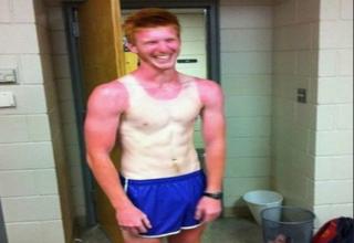 21 Insane Sunburns That Will Make You Fear the Sun - Ouch Gallery ...