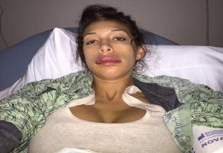 Farrah Abraham is a 23 year old Teen Mom star who recently had a lip enhancement procedure that didn't quite go as planned.
