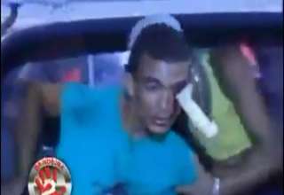 Guy With A Knife Stuck In His Eye