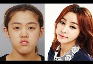 korean plastic surgery family